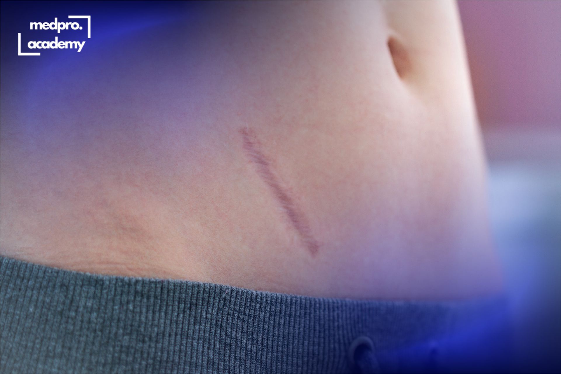 2Рубці шкіри сучасні аспекти діагностики та лікування